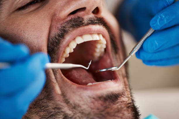Best Emergency Treatment for Oral Infections in Weidman, MI
